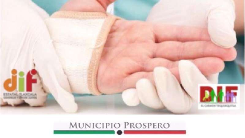 Cirugía de mano en Tequexquitla