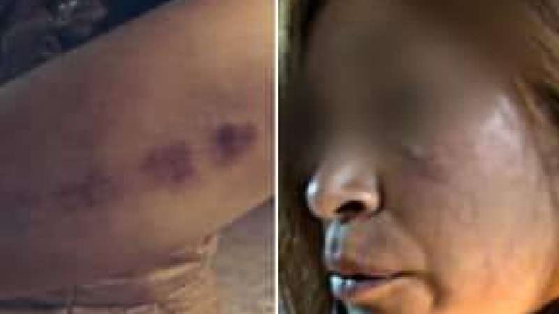 Denuncian a regidor de seguridad de Tlaltelulco por golpear a su cuña...